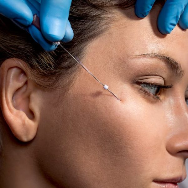 pdo thread lift miami fl elitestyles.com